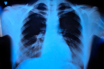 bs-X-Ray-6603494-300