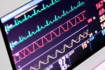bS-Monitoring-ECG-95196902_300