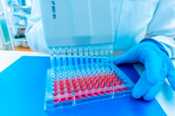 bs-in-laboratory-118996781-300