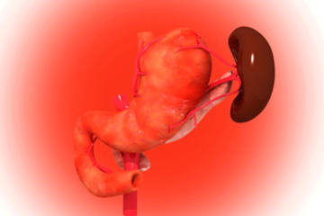 bs-pancreas-54709010-300