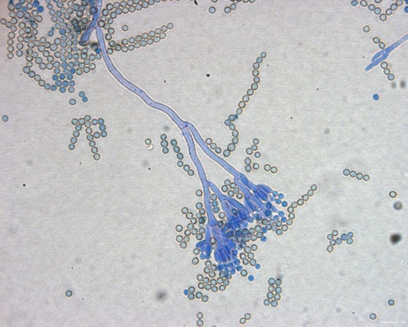 Penicillium chrysogenum
