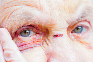bs-ElderlyWoman-193371076-400