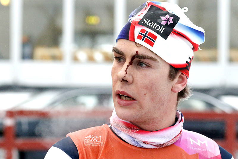 Mattis Stenshagen med tydelige spor i ansiktet etter 30 km skiathlon under NM på Gåsbu 2018. Foto: Erik Borg. Mattis Stenshagen med tydelige spor i ansiktet etter 30 km skiathlon under NM på Gåsbu 2018. Foto: Erik Borg.