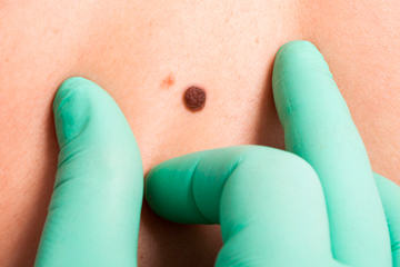 bs-Dermatolog-Inspecti--189619840-400