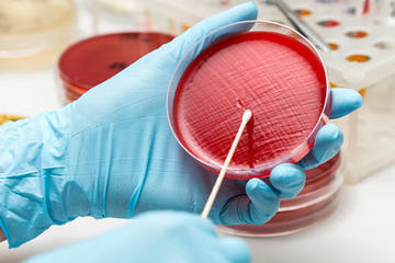 bs-bacteria_petridish-177999865-400