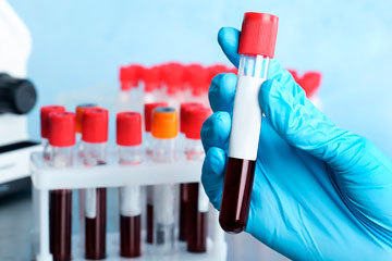 bs-blood-Tube-258423025-360