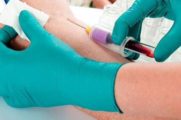 bs-Drawing-Blood-6001048-400