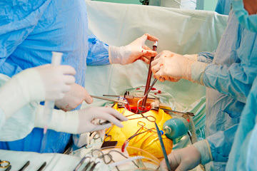 bs-surgeons-hands-78916727-360