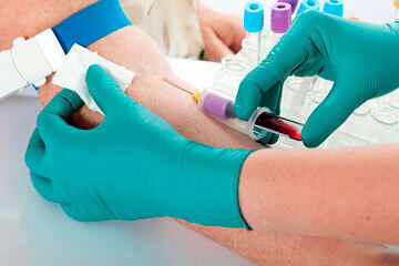 bs-Drawing-Blood-6001048-360