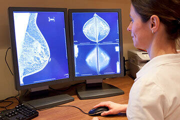 bs-Mammography-test-14967482-360