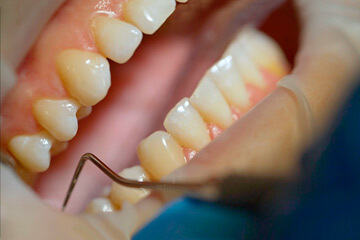 bs-Dentist-Examining--286161844-360