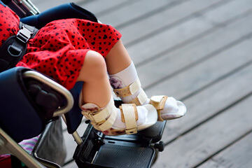bs-Disabled-Girl-307707334-360