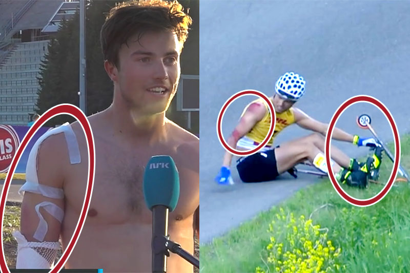 Håvard Moseby ble som bildene viser kraftig forslått da ski og binding løsnet under Holmenkollen Skishow 2021. Skjermdump: NRKs nett-TV. Collage: Langrenn.com. Håvard Moseby ble som bildene viser kraftig forslått da ski og binding løsnet under Holmenkollen Skishow 2021. Skjermdump: NRKs nett-TV. Collage: Langrenn.com.