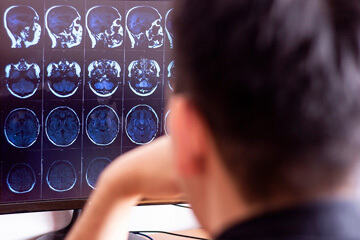 bs-Doctor-Radiologist-299887651-360