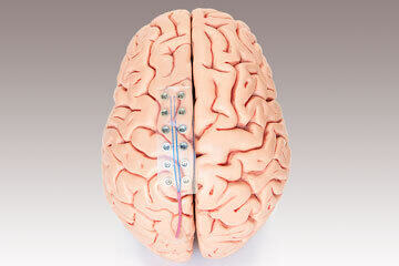 bs-Electrode-Brain-268449571-360