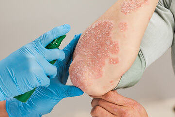 bis-Dermatologist--396825740-360